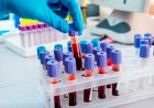Precisando de exames de laboratórios pelo SUS? Se liga nessa ação!